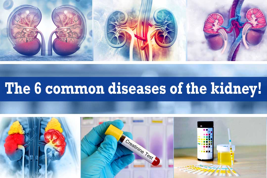 The-6-common-diseases-of-the-kidney!