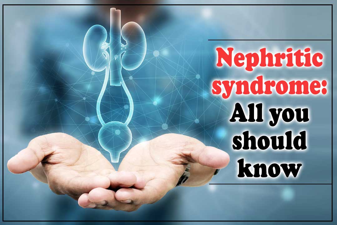 Nephritic-syndrome--All-you-should